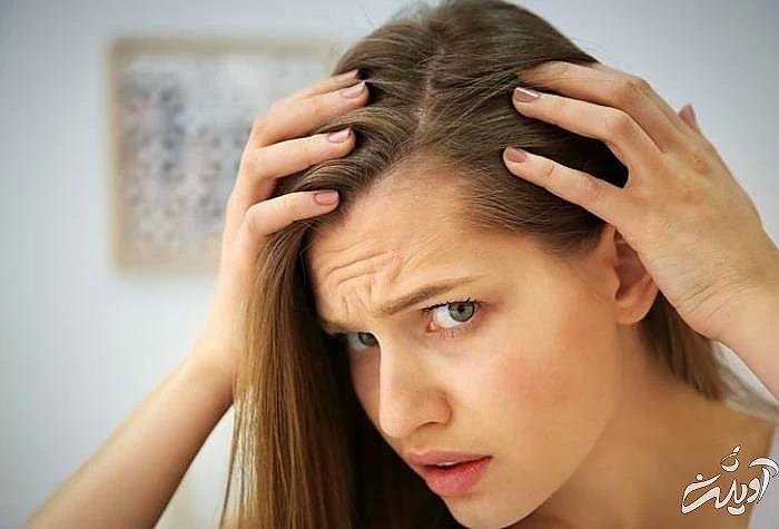 رفع مو خوره 